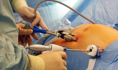 Cardiologist in bangalore