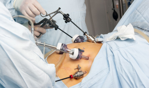how much lap band surgery cost
